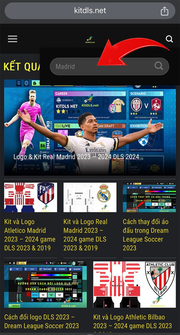 Cách thay đổi Kit DLS 2024